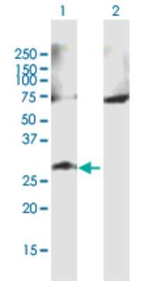 Western Blot: GALNT9 Antibody [H00050614-B01P]