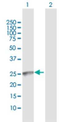 Western Blot: GALNT9 Antibody [H00050614-D01P]