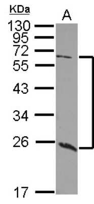 Western Blot: GALNT9 Antibody [NBP2-16598]