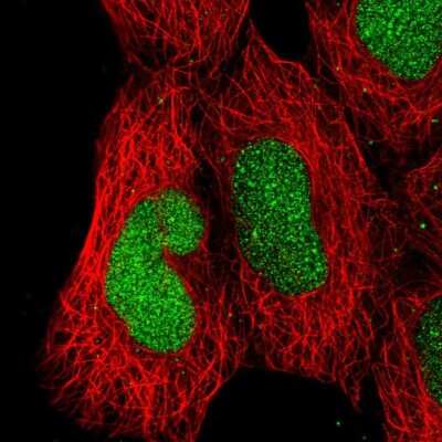 Immunocytochemistry/ Immunofluorescence: GALNTL1 Antibody [NBP2-31747]