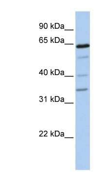 Western Blot: GALNTL1 Antibody [NBP1-59987]