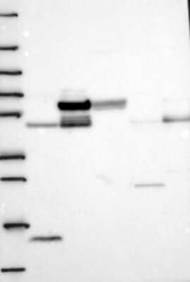 Western Blot: GALNTL1 Antibody [NBP3-17494]