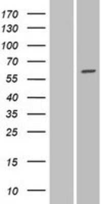 Western Blot: GALNTL1 Overexpression Lysate [NBP2-06624]