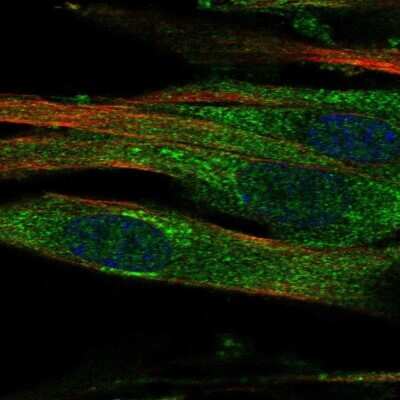 Immunocytochemistry/ Immunofluorescence: GALNTL2 Antibody [NBP1-81844]