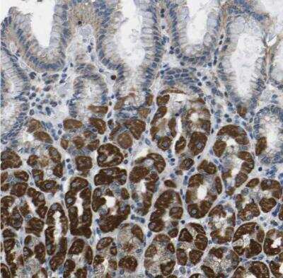 Immunohistochemistry-Paraffin: GALNTL2 Antibody [NBP1-81844]