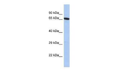 Western Blot: GALNTL2 Antibody [NBP2-82865]