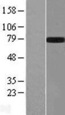 Western Blot: GALNTL2 Overexpression Lysate [NBL1-10959]