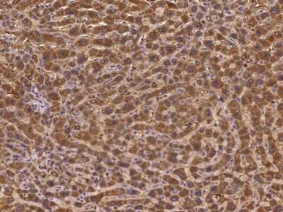 Immunohistochemistry: GALNTL4 Antibody [NBP3-06635]