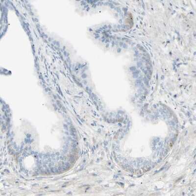 Immunohistochemistry-Paraffin: GALNTL5 Antibody [NBP1-81847]