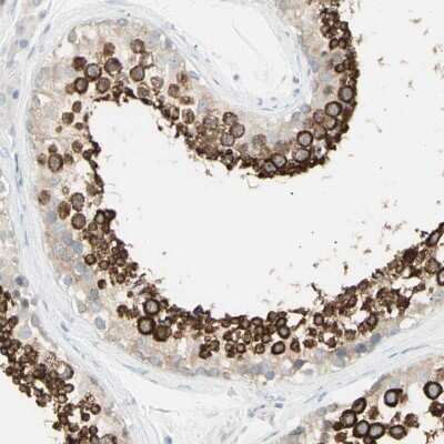 Immunohistochemistry-Paraffin: GALNTL5 Antibody [NBP1-81847]