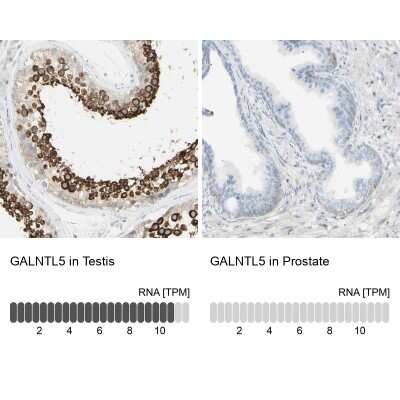Immunohistochemistry-Paraffin: GALNTL5 Antibody [NBP1-81847]