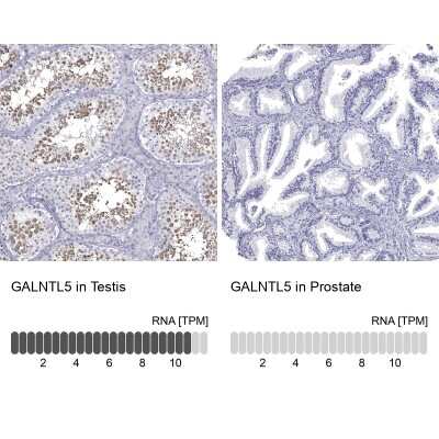 Immunohistochemistry-Paraffin: GALNTL5 Antibody [NBP1-81847]