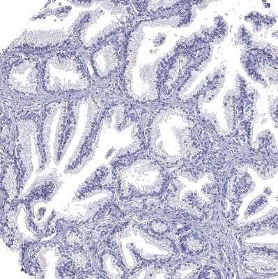 Immunohistochemistry-Paraffin: GALNTL5 Antibody [NBP1-81847]