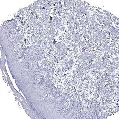 Immunohistochemistry-Paraffin: GALNTL5 Antibody [NBP1-81847]