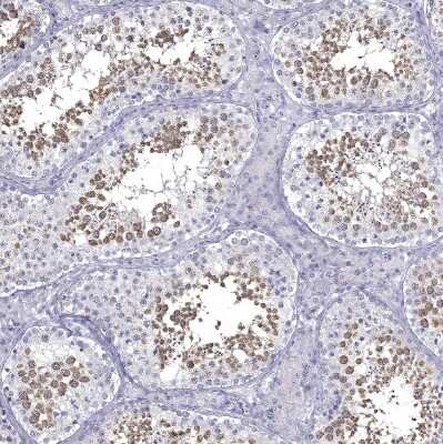Immunohistochemistry-Paraffin: GALNTL5 Antibody [NBP1-81847]