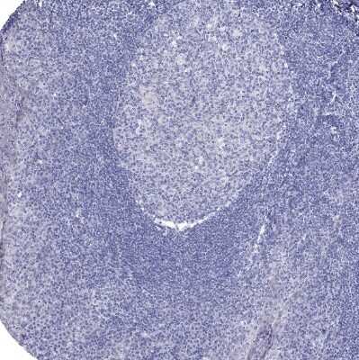 Immunohistochemistry-Paraffin: GALNTL5 Antibody [NBP1-81847]