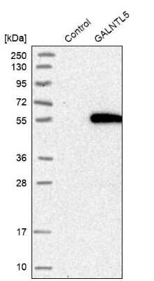 Western Blot: GALNTL5 Antibody [NBP1-81847]