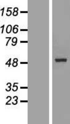 Western Blot: GALNTL5 Overexpression Lysate [NBL1-10960]