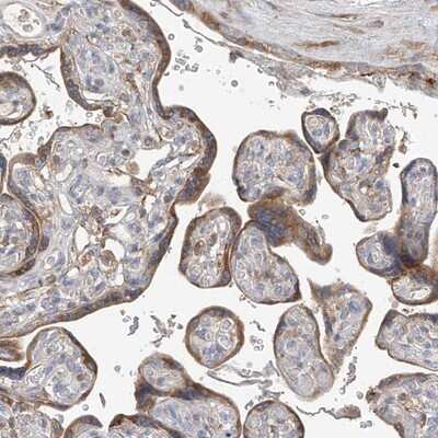 Immunohistochemistry-Paraffin: GALNTL6 Antibody [NBP1-81845]