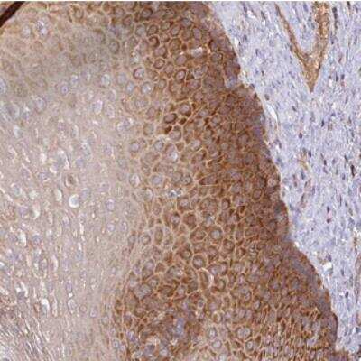 Immunohistochemistry-Paraffin: GALP Antibody [NBP2-30821]