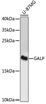 Western Blot: GALP AntibodyAzide and BSA Free [NBP3-04896]