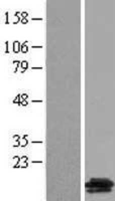 Western Blot: GALP Overexpression Lysate [NBL1-10961]