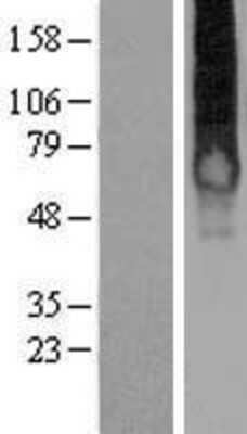 Western Blot: Galanin R1/GALR1 Overexpression Lysate [NBP2-08207]