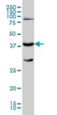 Western Blot: GALT Antibody (4C11) [H00002592-M01]