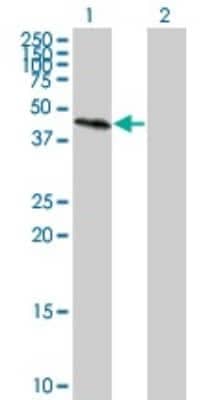 Western Blot: GALT Antibody (4C11) [H00002592-M01]