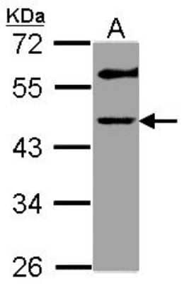 Western Blot: GALT Antibody [NBP1-33585]