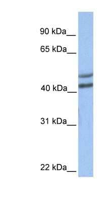 Western Blot: GALT Antibody [NBP1-54980]