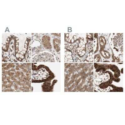 Immunohistochemistry-Paraffin: GALT Antibody [NBP1-86138]