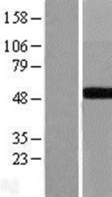 Western Blot: GALT Overexpression Lysate [NBL1-10964]