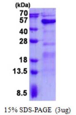 SDS-PAGE: Recombinant Human GALT His Protein [NBP2-23068]