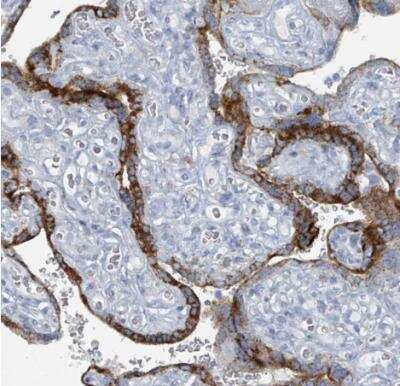 Immunohistochemistry-Paraffin: GAMT Antibody [NBP2-14036]