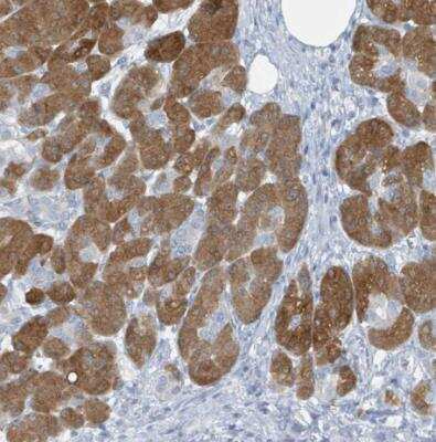 Immunohistochemistry-Paraffin: GAMT Antibody [NBP2-14036]