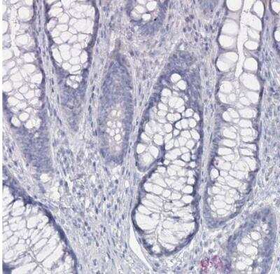 Immunohistochemistry-Paraffin: GAMT Antibody [NBP2-14036]