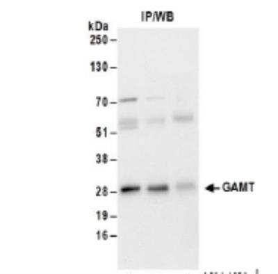 Immunoprecipitation: GAMT Antibody [NBP2-34854]