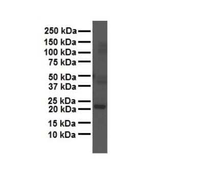 Western Blot: GAMT Antibody [NBP1-54399]