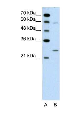 Western Blot: GAMT Antibody [NBP1-54819]