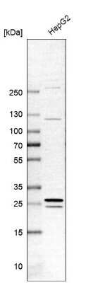 Western Blot: GAMT Antibody [NBP2-14036]