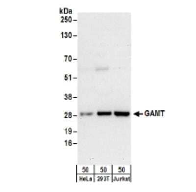 Western Blot: GAMT Antibody [NBP2-34854]