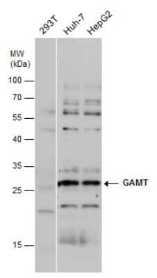 Western Blot: GAMT Antibody [NBP3-12967]