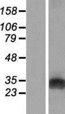 Western Blot: GAMT Overexpression Lysate [NBP2-09052]