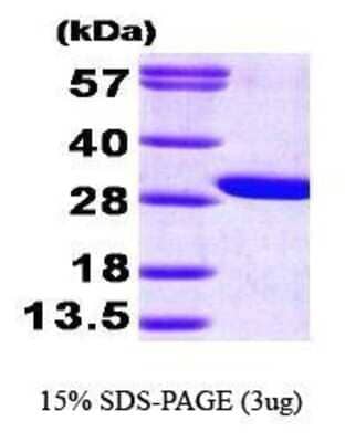 SDS-PAGE: Recombinant Human GAMT His Protein [NBP1-30287]