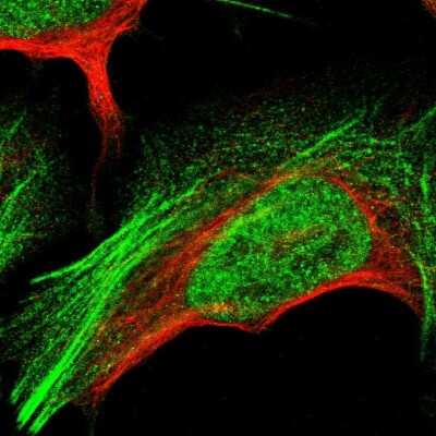 Immunocytochemistry/ Immunofluorescence: GANC Antibody [NBP1-86448]