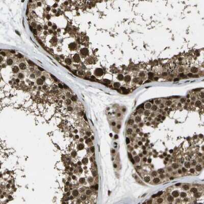 Immunohistochemistry-Paraffin: GANC Antibody [NBP1-86448]
