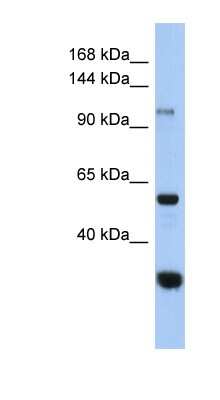 Western Blot: GANC Antibody [NBP1-56805]