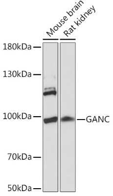 Western Blot: GANC AntibodyAzide and BSA Free [NBP3-03889]