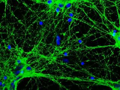 Immunocytochemistry/ Immunofluorescence: GAP-43 Antibody (5E8) [NBP2-50052]
